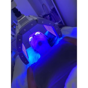 Blue light therapy being used to treat acne o n a womens face