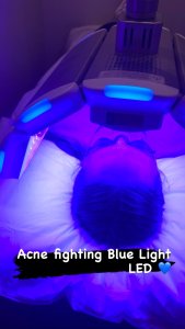 Women neck and face being treated with blue light LED therapy